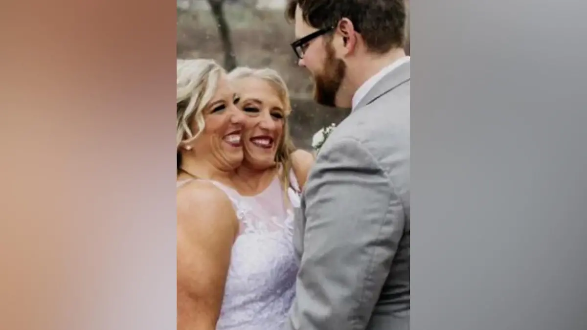 Frisch verheiratet: Zwillingsschwester Abby heiratet ihren Josh.