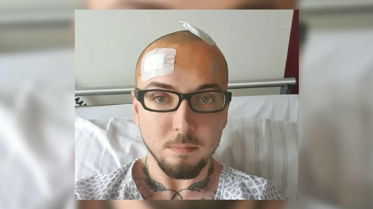 Nicolas Bauch hat einen Gehirntumor.