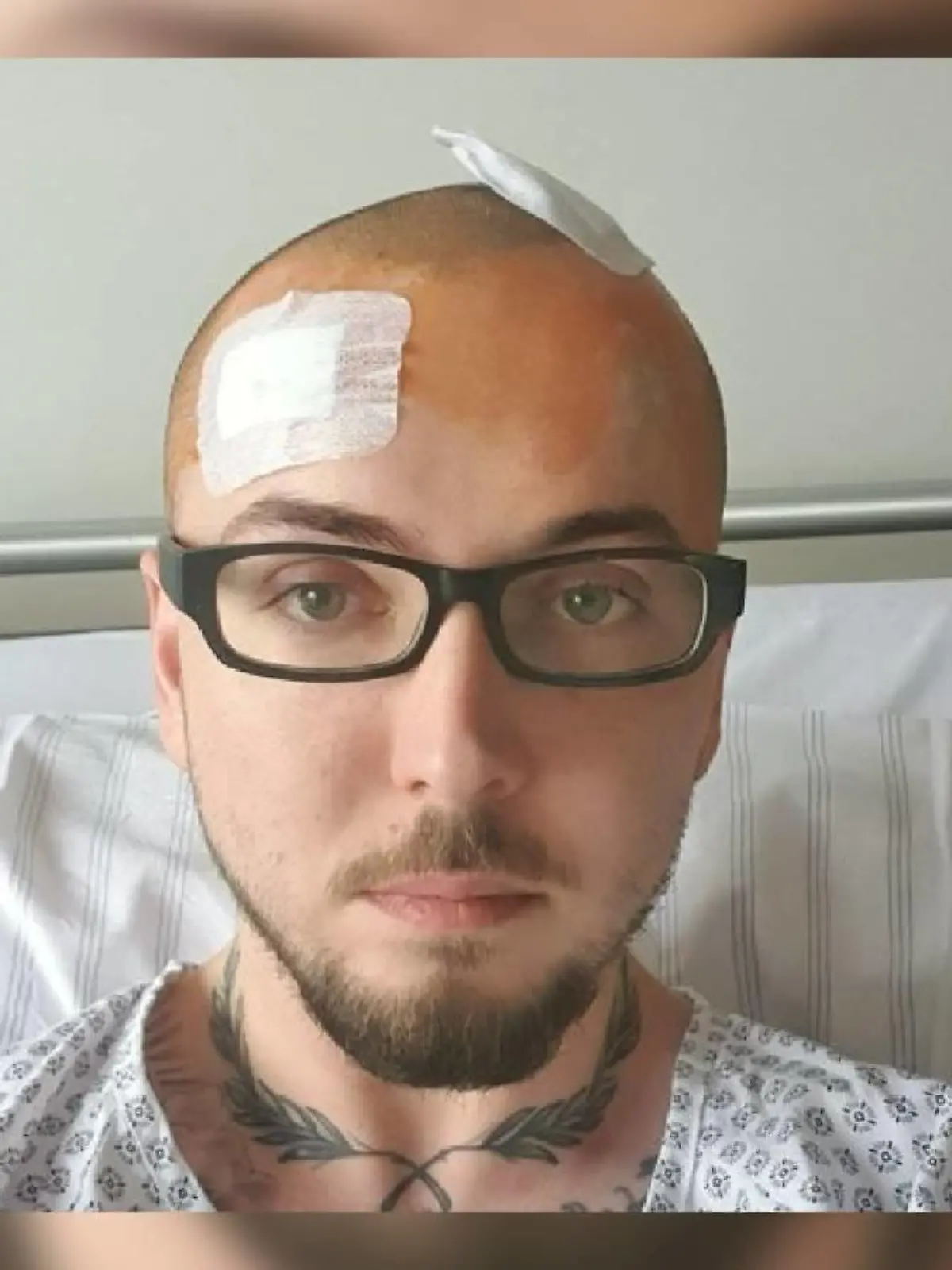 Nicolas Bauch hat einen Gehirntumor.