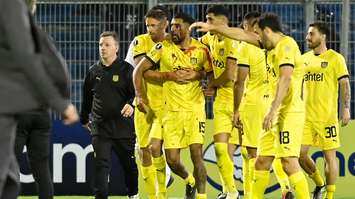 Peñarol's defender Maximiliano Olivera (C) is covered in blood after a fan of Rosario Central throwed an object from the stands during the Copa Libertadores group stage first leg football match between Argentina's Rosario Central and Uruguay's Peñarol at the Gigante de Arroyito Stadium in Rosario, Argentina, on April 4, 2024. (Photo by Marcelo Manera / AFP) (Photo by MARCELO MANERA/AFP via Getty Images)
