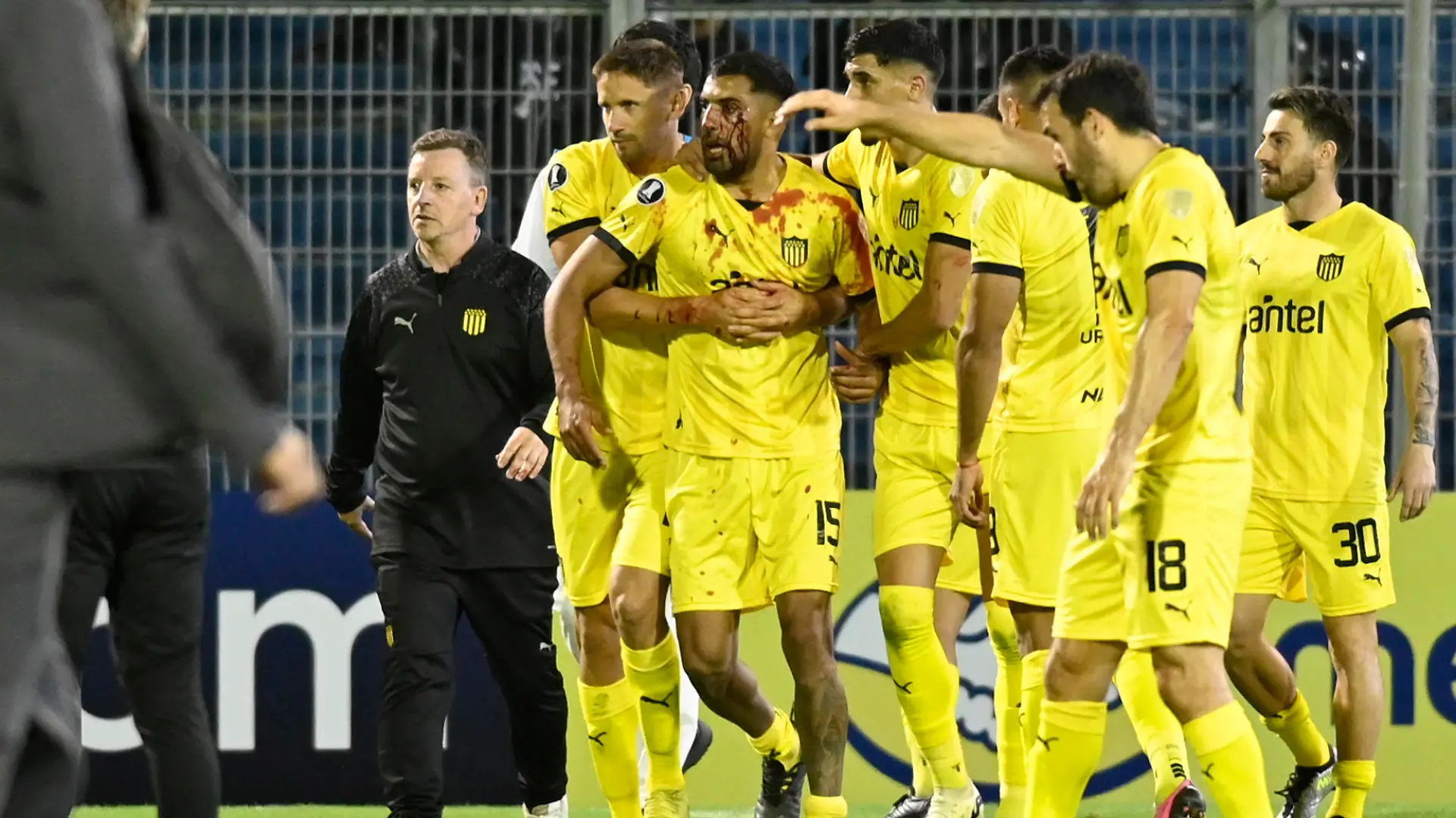 Peñarol's defender Maximiliano Olivera (C) is covered in blood after a fan of Rosario Central throwed an object from the stands during the Copa Libertadores group stage first leg football match between Argentina's Rosario Central and Uruguay's Peñarol at the Gigante de Arroyito Stadium in Rosario, Argentina, on April 4, 2024. (Photo by Marcelo Manera / AFP) (Photo by MARCELO MANERA/AFP via Getty Images)