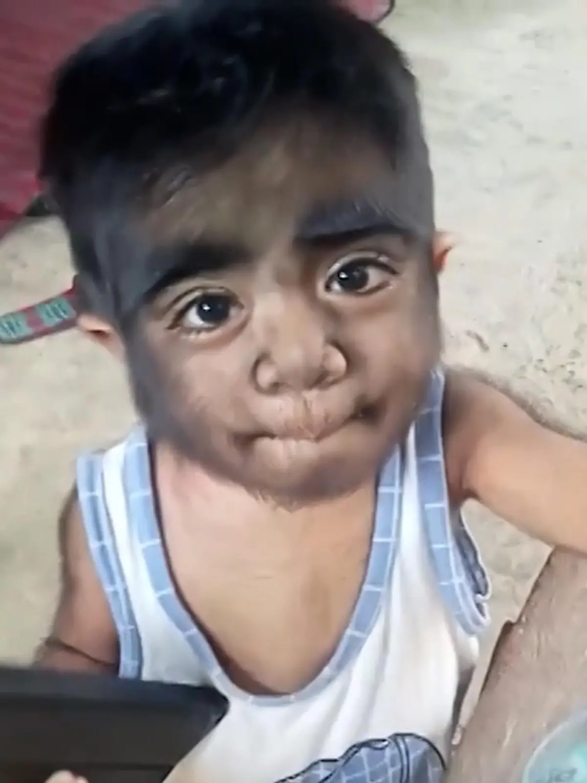 Der kleine Jaren Gamongan von den Philippinen ist zwei Jahre alt und sieht aus, wie ein Werwolf. Seine Mama Alma glaubt an einen Fluch. Was wirklich dahintersteckt, erfahrt ihr im Video.