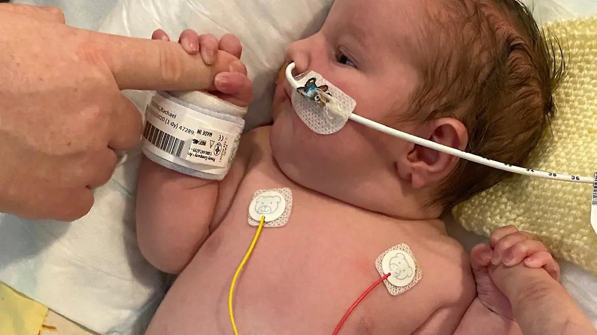 Rachael Young kam mit 100 Tumoren zur Welt und musste fast 1.000 Chemotherapie-Sitzungen über sich ergehen lassen.