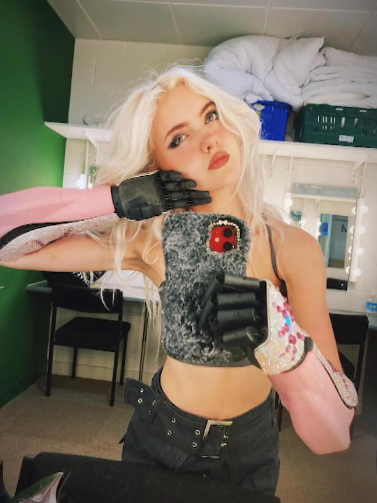 Der Begriff „Body Positivity“, sprich: eine positive Einstellung zum eigenen Körper, ist aus dem Netz längst nicht mehr wegzudenken. Unzählige Influencer leben das vor und wollen so auch ihre Follower in Sachen Selbstwert und Selbstliebe stärken. Makel zu haben, ist nichts, was versteckt werden muss, im Gegenteil! Das beweisen auch die so genannten „Cyborgs of Instagram“