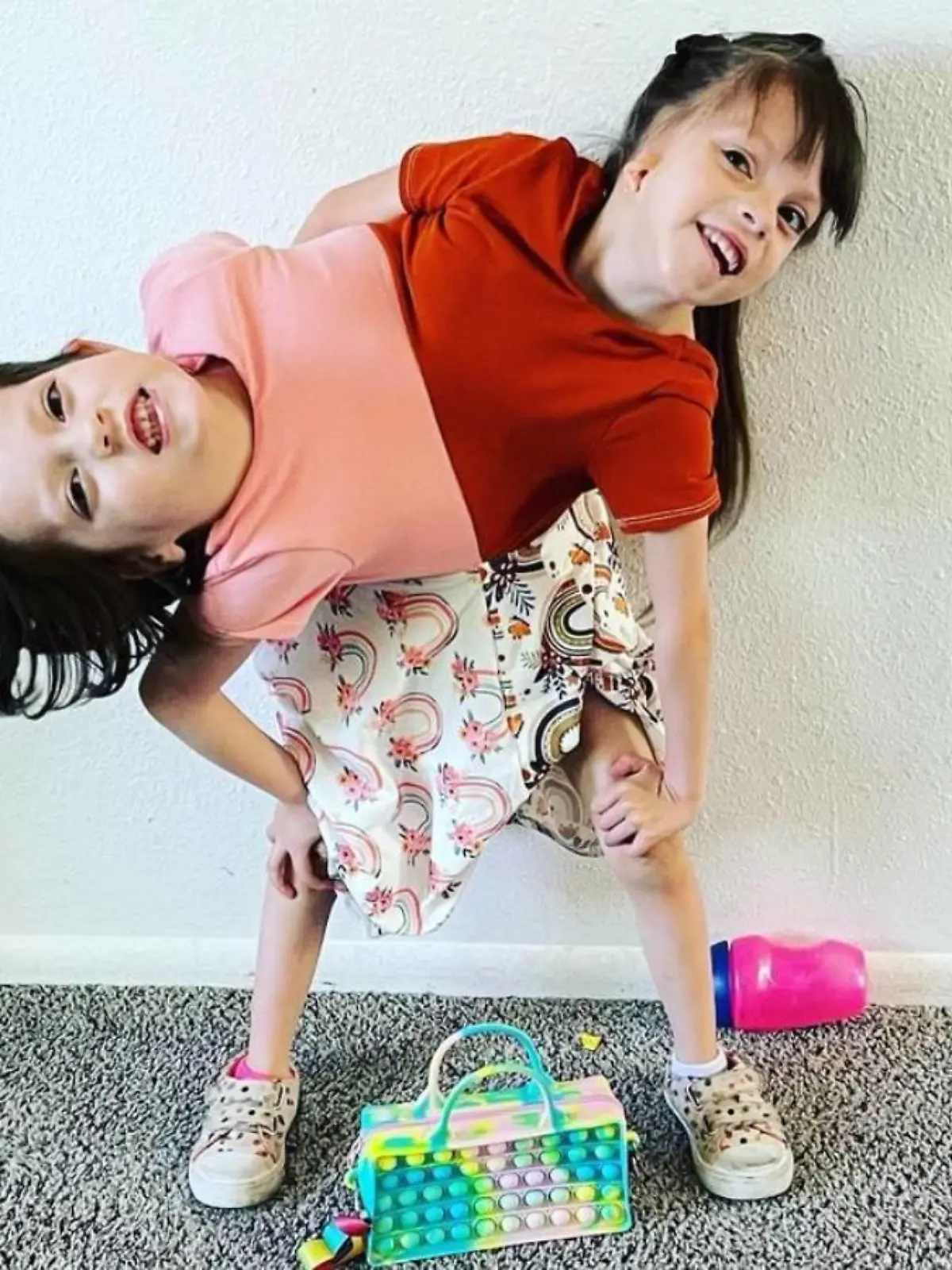 Die siamesischen Zwillinge Callie und Carter stehen vor einer Wand