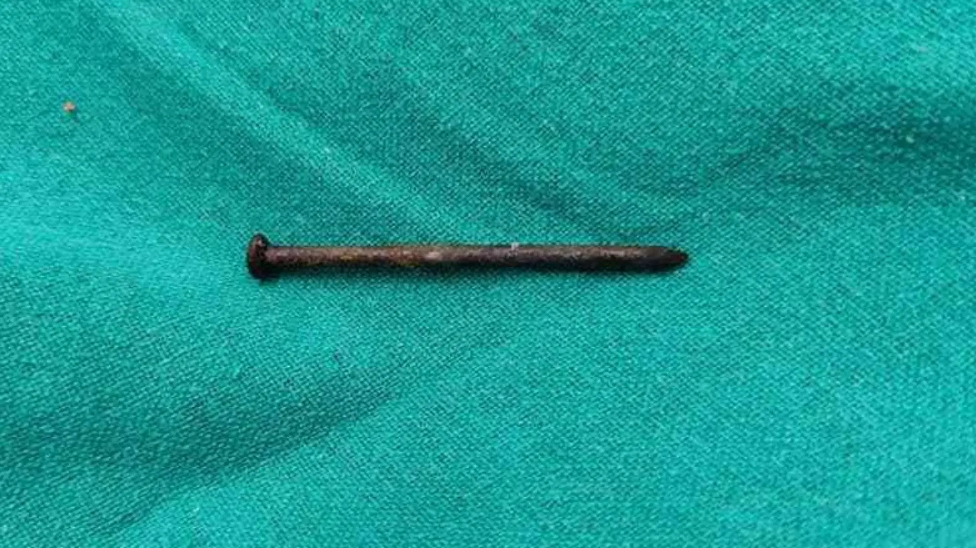 Story from Jam Press (Nailed It)
Pictured: The 4-inch iron nail stuck in Jagram’s bladder.
Man has four-inch iron nail stuck in bladder for a YEAR
Surgeons at a hospital in India were left baffled after pulling a four-inch nail from a male patient's bladder – after it had been lodged there for an entire year.
The patient, named Jagram, began experiencing discomfort in his bladder area a year earlier and attended Bhind District Hospital after his pain had become excruciating.
Concerned by the man’s symptoms, surgical specialist, Dr Prateek Mishra ordered blood tests, as well as an ultrasound and X-ray.
Finally, they nailed down what their patient had been suffering all along – and it wasn’t for the faint-hearted.
To the bafflement of doctors, the scan showed a four-inch nail sitting inside the patient’s bladder.
But what was still not clear was how the iron nail came to be in the man's body.
With little information as to how it could have happened, doctors had to ask fast.
The patient was not able to afford medical care but all doctors were in agreement that they would perform the surgery for free to finally end the man’s pain.
It took doctors nearly an hour to remove the nail from the patient, in what the hospital described as a “first”.
The patient has now returned to full health.
ENDS