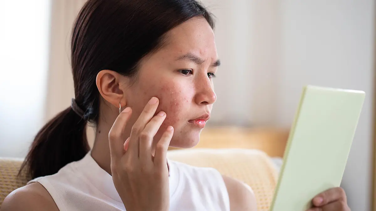 Portrait of Asian woman worry about her face when she saw the problem of acne inflammation and scar by the mini mirror.
