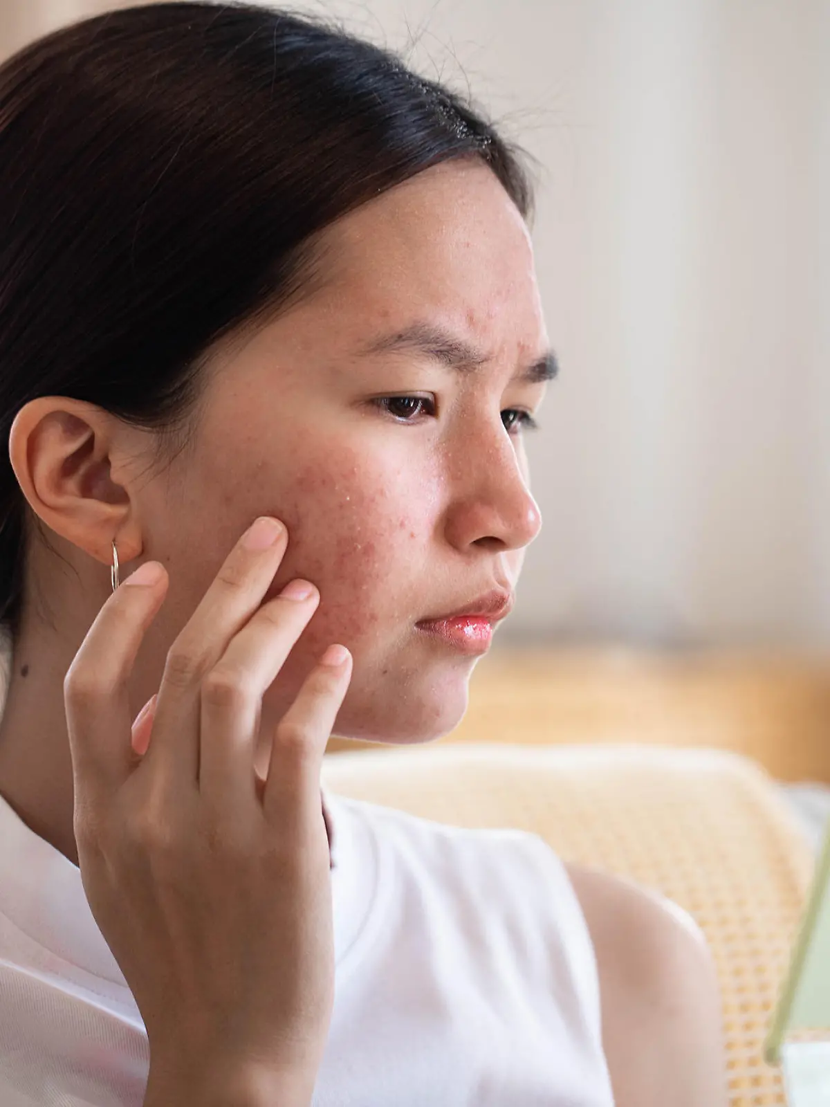 Portrait of Asian woman worry about her face when she saw the problem of acne inflammation and scar by the mini mirror.