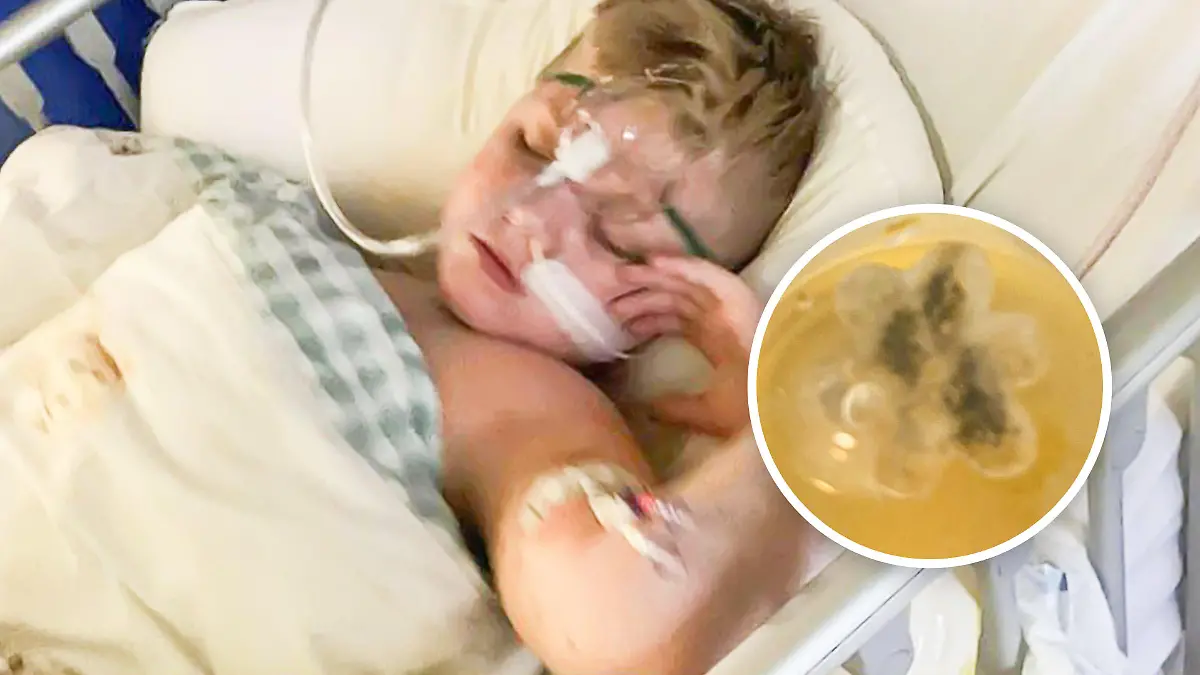 Collage: Marley im Krankenhaus; Foto der Spielzeugblume, die in seinem Hals steckte.