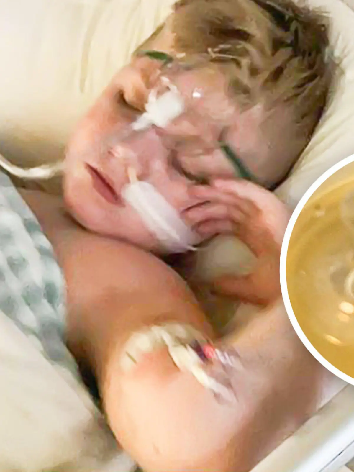 Collage: Marley im Krankenhaus; Foto der Spielzeugblume, die in seinem Hals steckte.