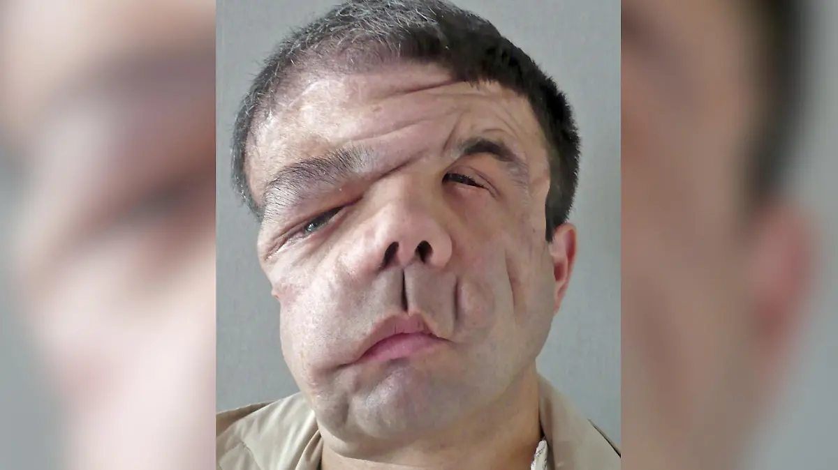 Ein Mann mit einem kranken Gesicht.