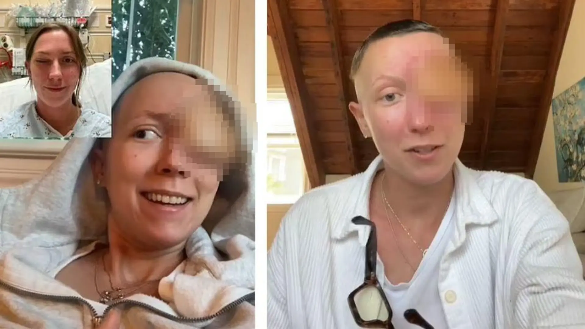Annika vor und nach ihrer Augen-Operation.