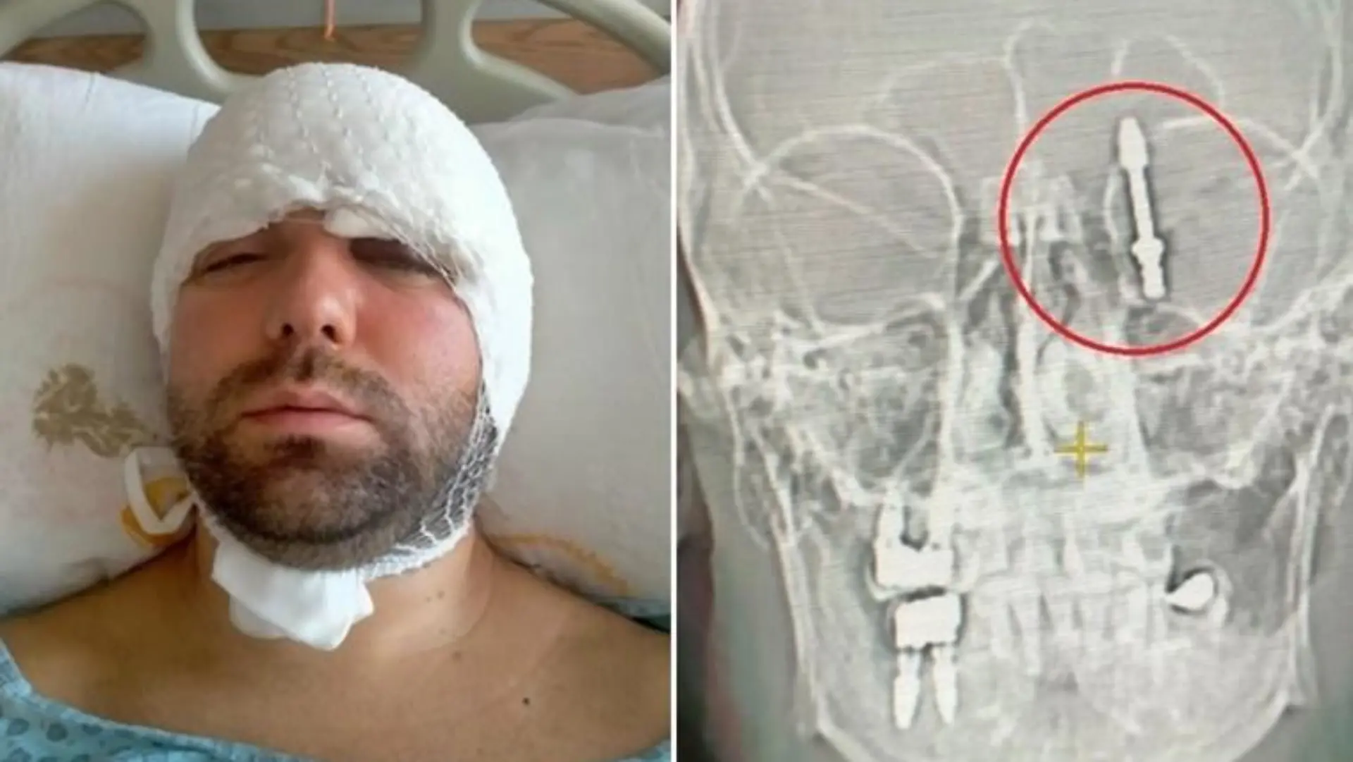 Mann im Krankenhaus