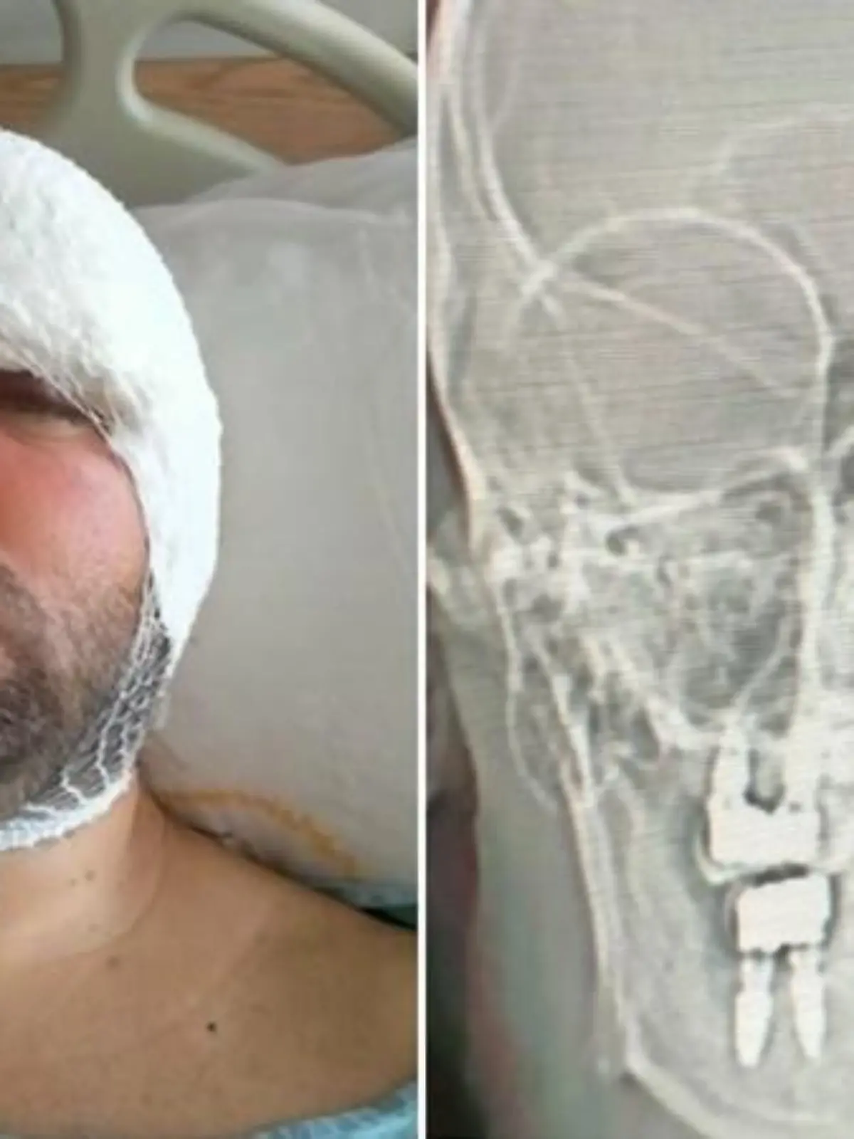 Mann im Krankenhaus