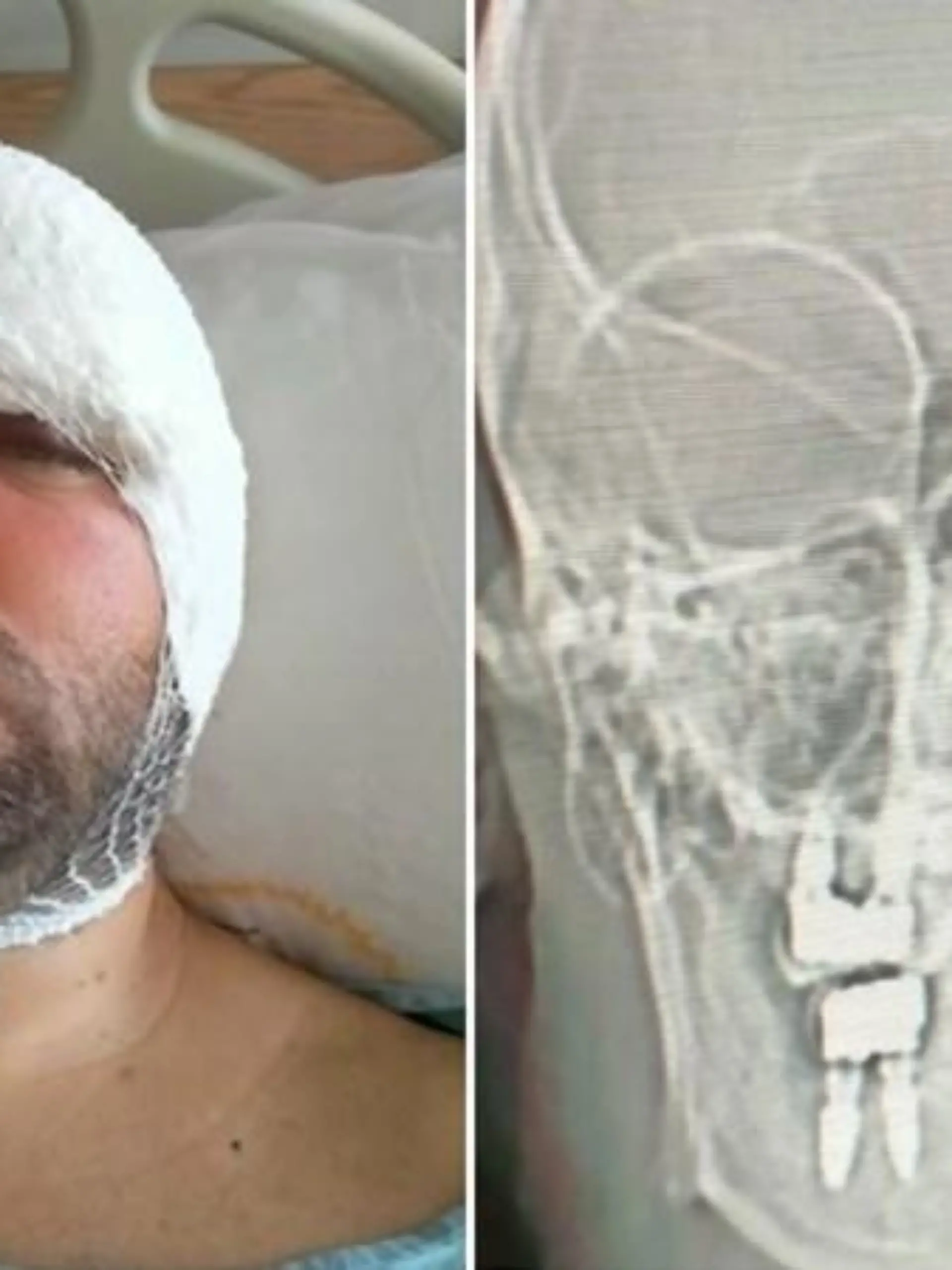 Mann im Krankenhaus