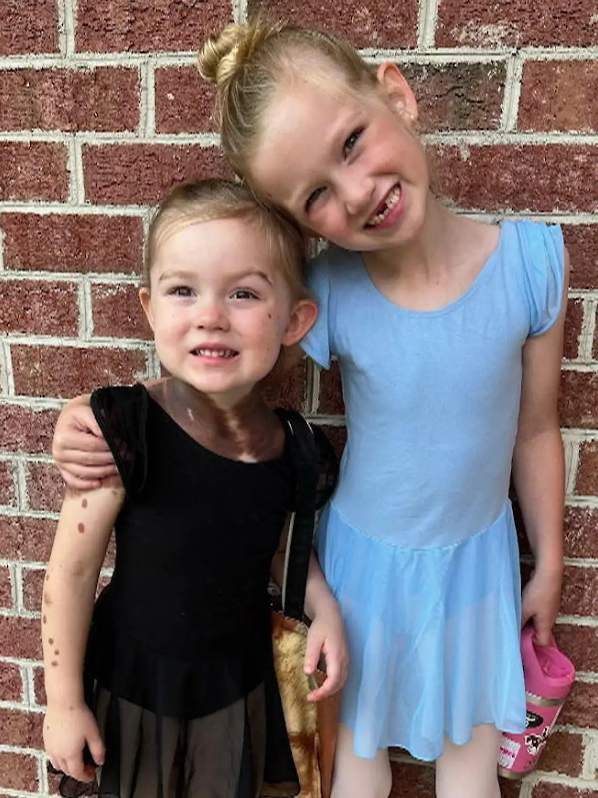 Die kleine Addie aus den USA ist erst vier Jahre alt und hat bereits über 30 medizinische Eingriffe hinter sich, denn: Ein riesiger Pigmentfleck erstreckt sich über ihren Hals! Kurz nach der Geburt hatten ihre Eltern sogar Angst, die Kleine würde daran sterben!
Wie sie und ihre Eltern mit der Erkrankung umgehen und warum Außenstehende die Familie kritisieren, erfahrt ihr im Video.