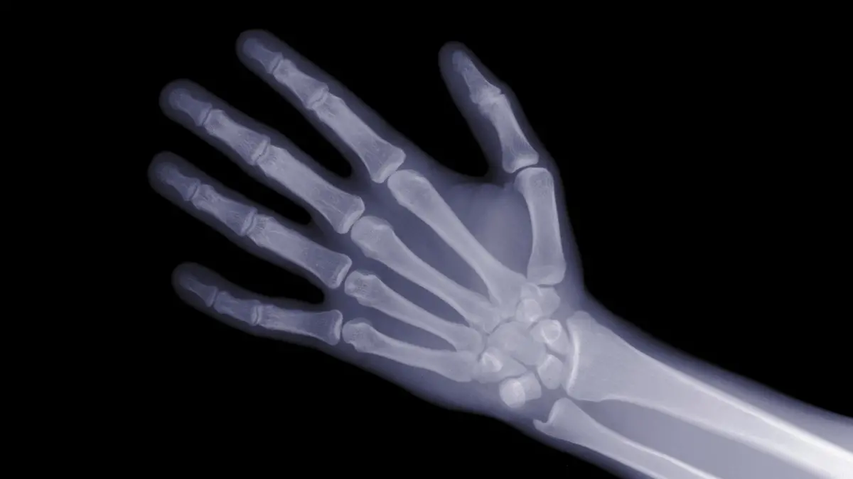 Ein Röntgen-Hand.