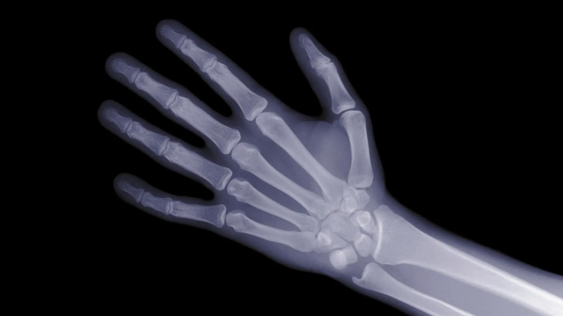 Ein Röntgen-Hand.