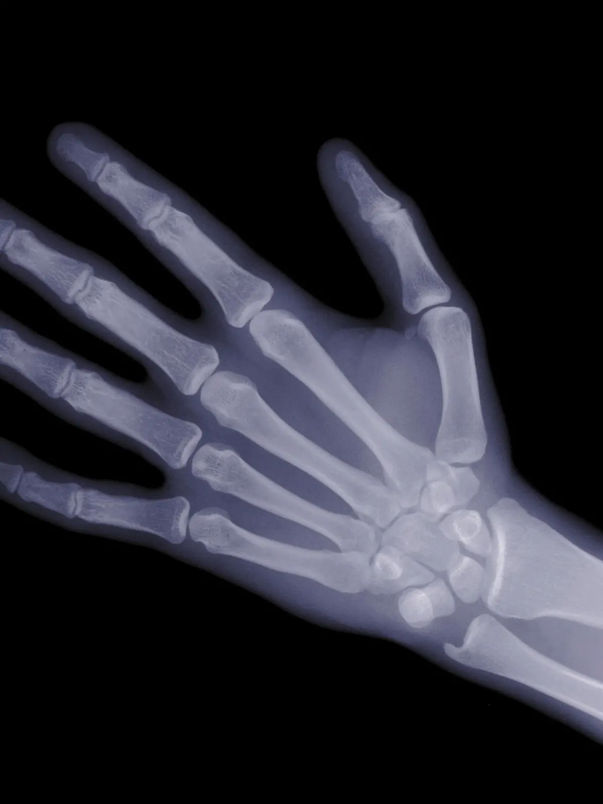 Ein Röntgen-Hand.
