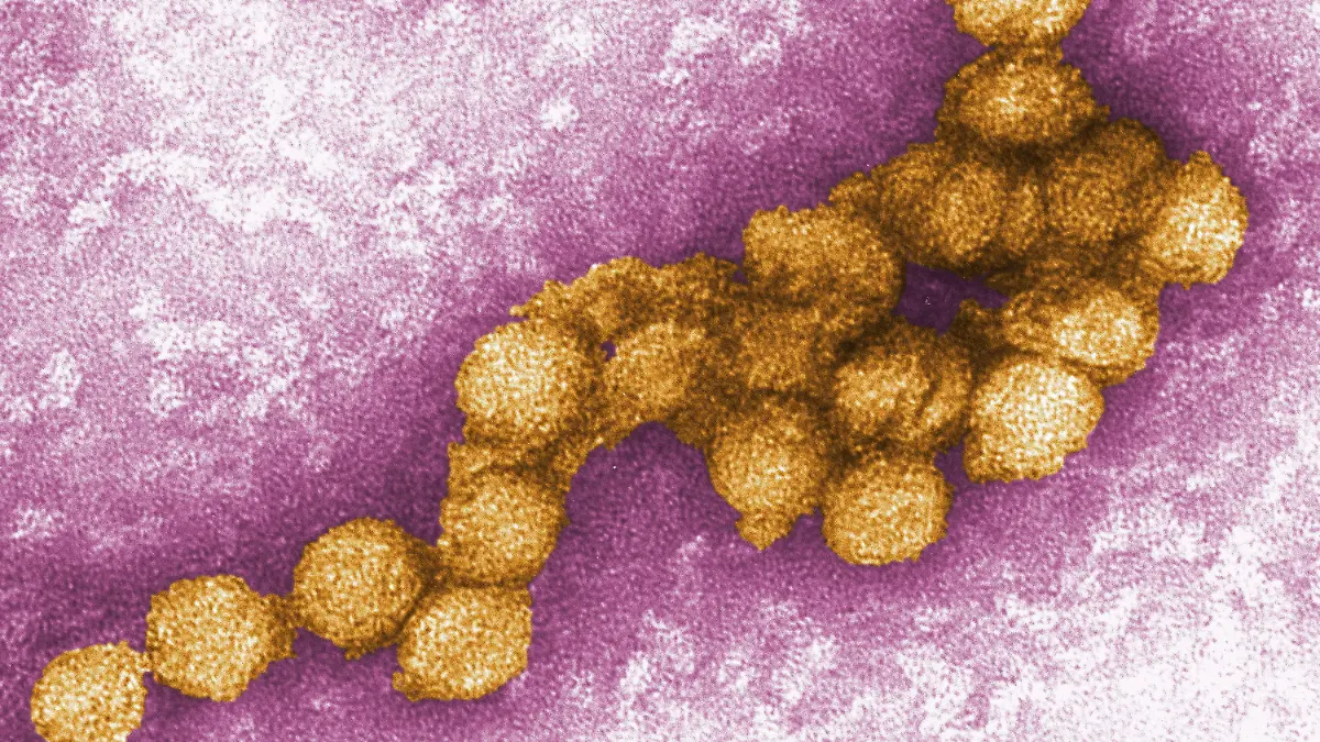 HANDOUT - 26.08.2008, USA, Atlanta: Dieses von den Centers for Disease Control zur Verfügung gestellte Foto zeigt eine elektronenmikroskopische Aufnahme des West-Nil-Virus. (zu dpa: "Klimawandel bringt Überträger von Krankheiten nach Deutschland") Foto: Cynthia Goldsmith/CENTERS FOR DISEASE CONTROL/EPA/dpa - ACHTUNG: Nur zur redaktionellen Verwendung und nur mit vollständiger Nennung des vorstehenden Credits +++ dpa-Bildfunk +++