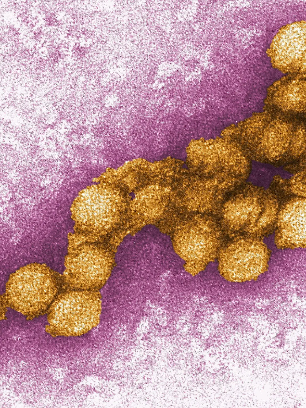 HANDOUT - 26.08.2008, USA, Atlanta: Dieses von den Centers for Disease Control zur Verfügung gestellte Foto zeigt eine elektronenmikroskopische Aufnahme des West-Nil-Virus. (zu dpa: "Klimawandel bringt Überträger von Krankheiten nach Deutschland") Foto: Cynthia Goldsmith/CENTERS FOR DISEASE CONTROL/EPA/dpa - ACHTUNG: Nur zur redaktionellen Verwendung und nur mit vollständiger Nennung des vorstehenden Credits +++ dpa-Bildfunk +++