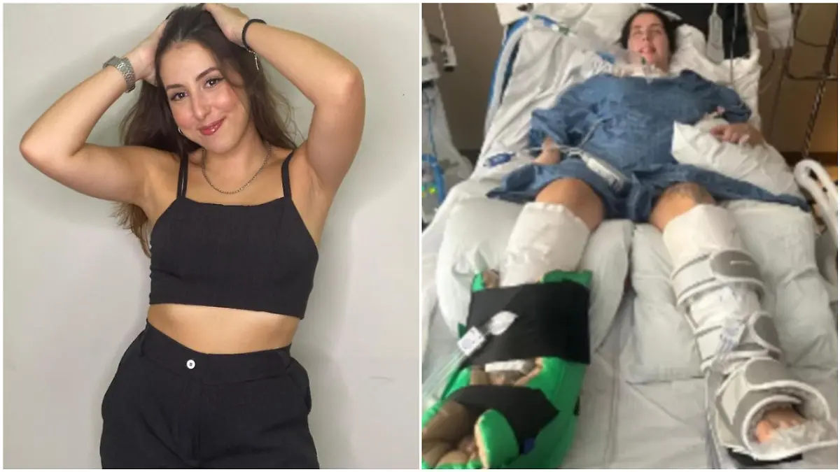 Claudia de Albuquerque Celada (23) erkrankte schwer an Botulismus, einer seltenen bakteriellen Infektion.
