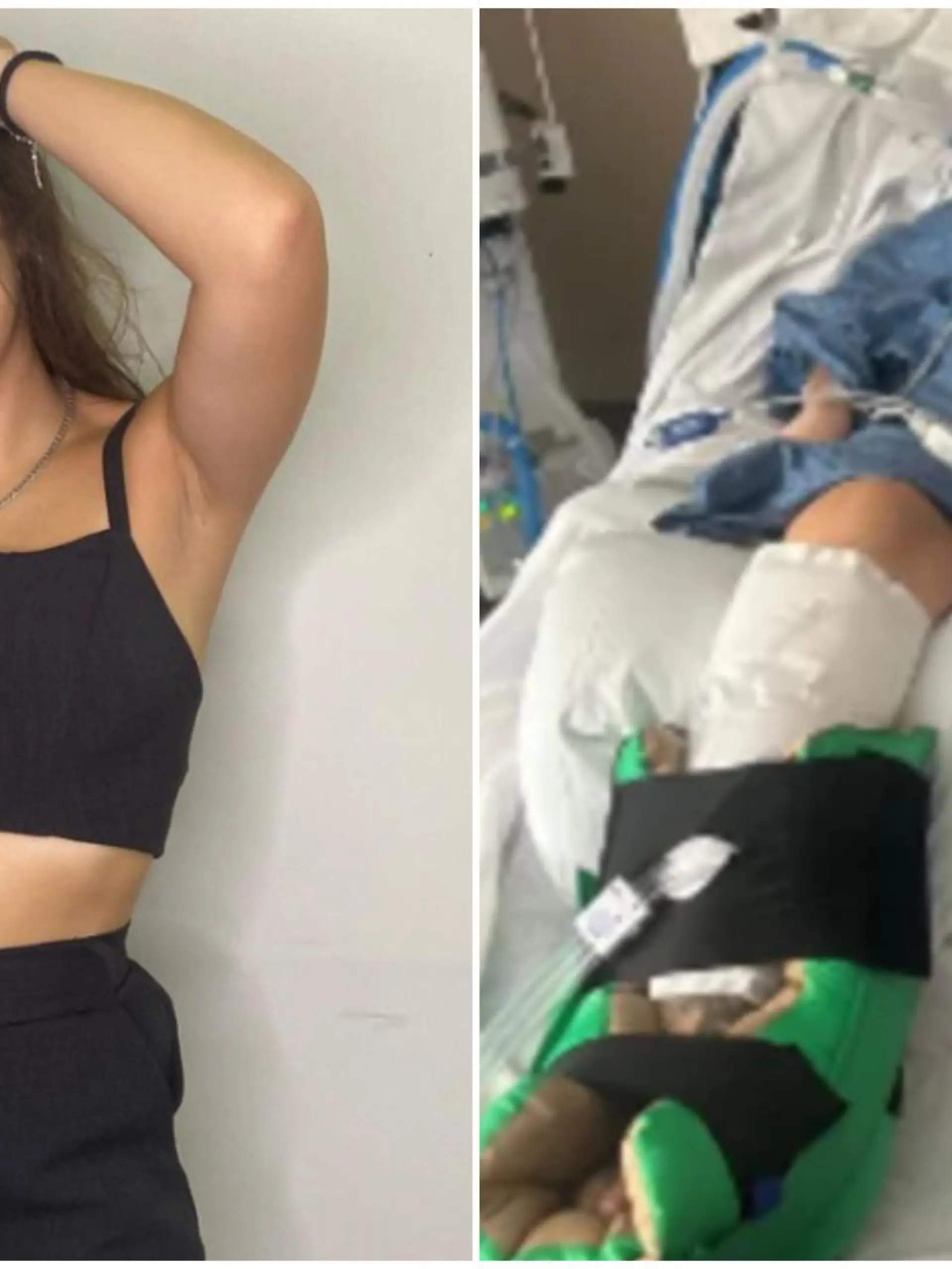 Claudia de Albuquerque Celada (23) erkrankte schwer an Botulismus, einer seltenen bakteriellen Infektion.