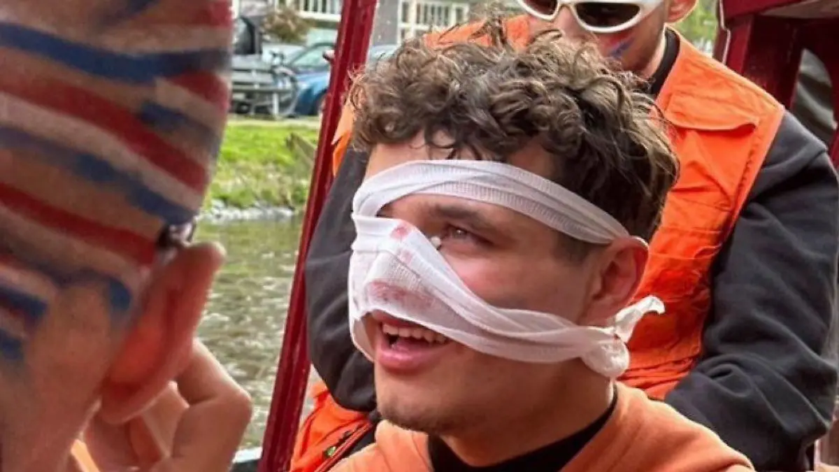Lando Norris hat bei einer Bootsparty ordentlich was abbekommen.