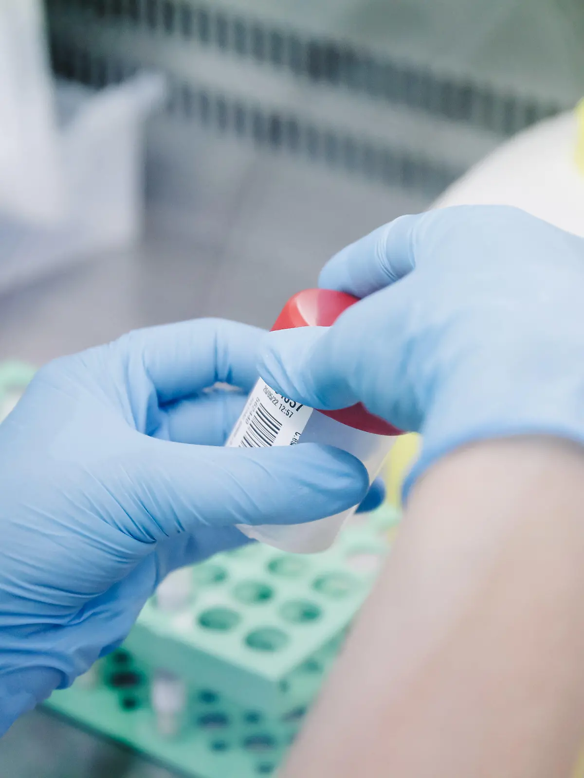 ARCHIV - 30.05.2022, Spanien, Madrid: Eine Krankenschwester führt im Krankenhaus Ramon y Cajal in Madrid einen PCR-Test zur Erkennung des Affenpockenvirus durch. Angesichts der schnellen weiten Verbreitung der Affenpocken hat die Weltgesundheitsorganisation (WHO) die höchste Alarmstufe ausgerufen. (zu dpa «Höchste Alarmstufe: Affenpocken-Ausbruch ist internationale Notlage») Foto: Carlos Luján/EUROPA PRESS/dpa +++ dpa-Bildfunk +++