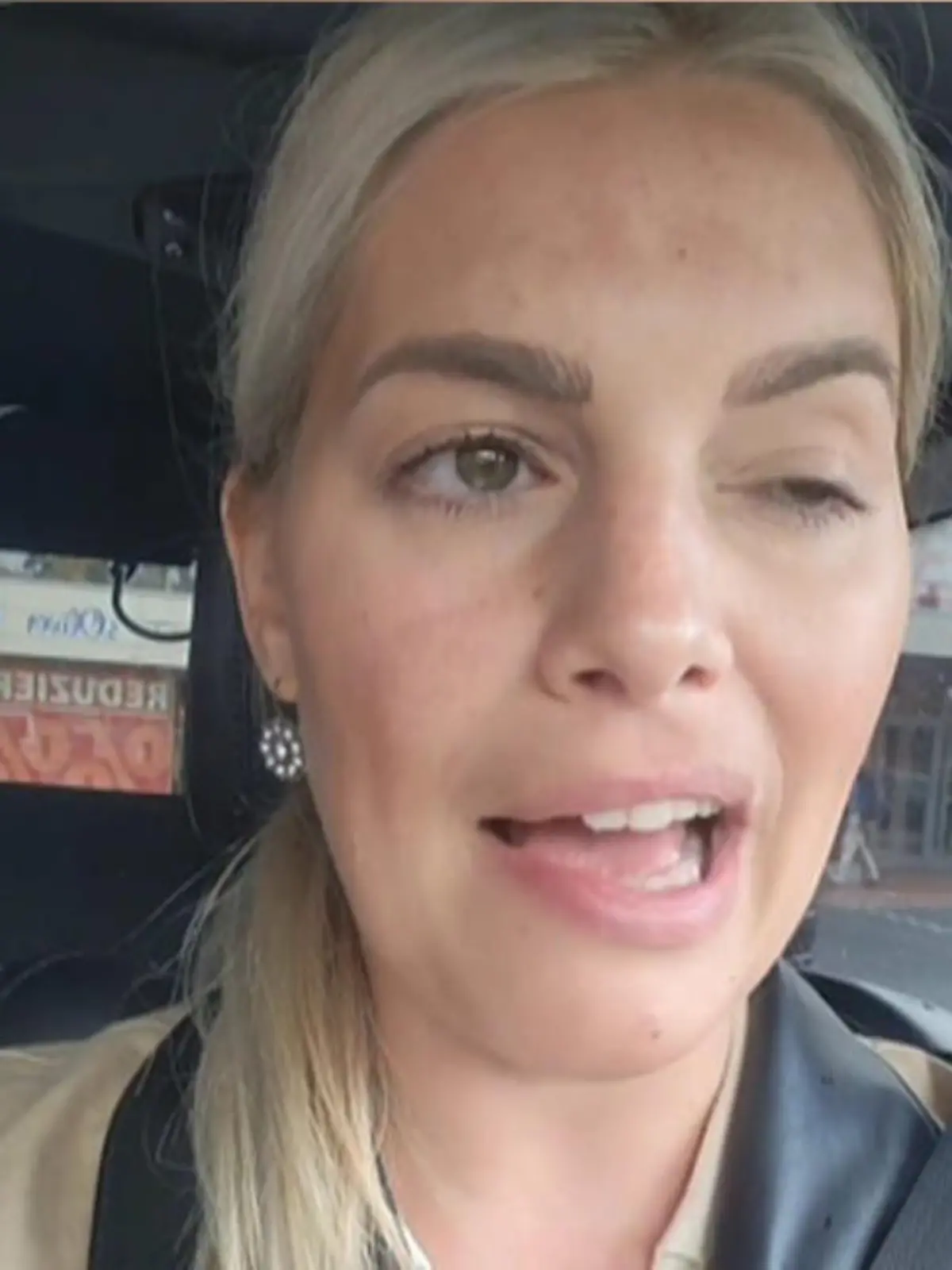 Angelina Kirschs linke Gesichtshälfte ist seit Montag plötzlich gelähmt.
