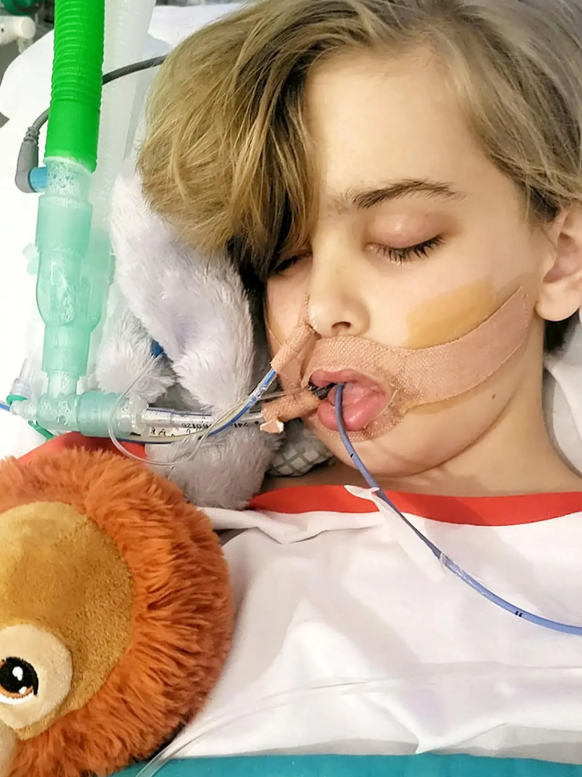 Archie mit Schläuchen im Krankenbett