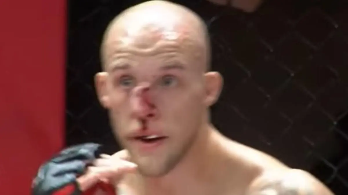 Puh, Blake Perrys Nase ist nach einem MMA-Kampf komplett verbogen.