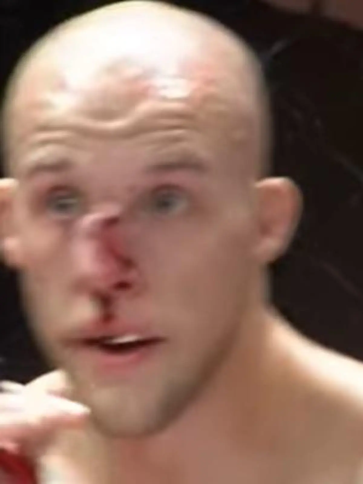 Puh, Blake Perrys Nase ist nach einem MMA-Kampf komplett verbogen.