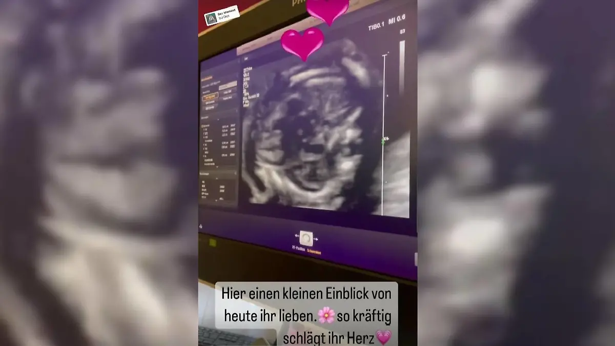 In ihrer Instagram-Story teilt die Schwangere eine Ultraschall-Aufnahme