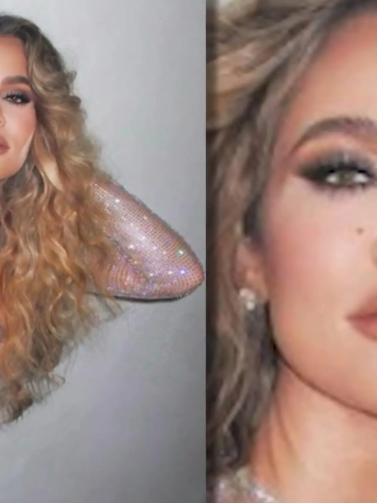 Bild zu: "Khloé Kardashian wurde ein Tumor aus dem Gesicht entfernt"
