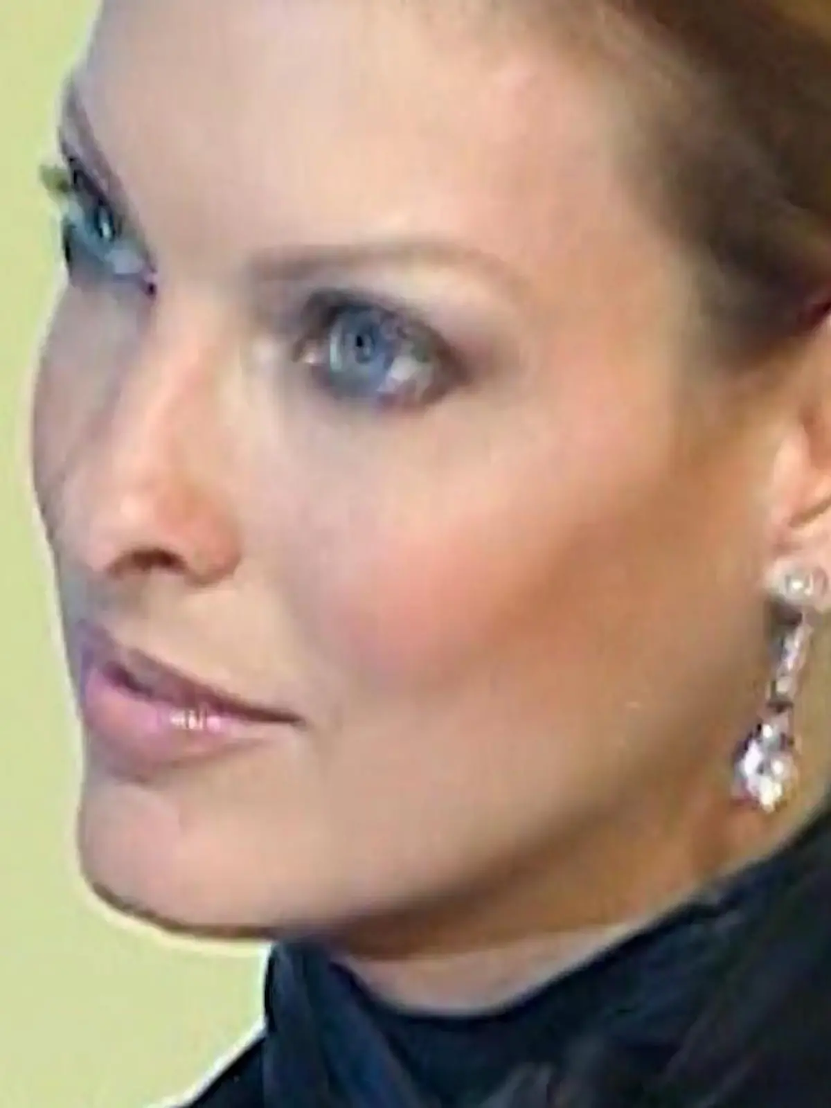 Bild zu: "Nach verpfuschter Beauty-OP auf dem "Vogue"-Cover"