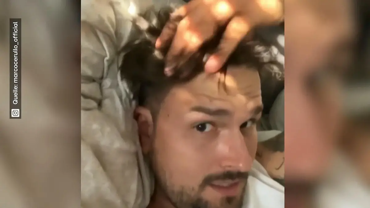 Marco Cerullos Haar-Transplantation trägt Früchte! Volle Mähne
