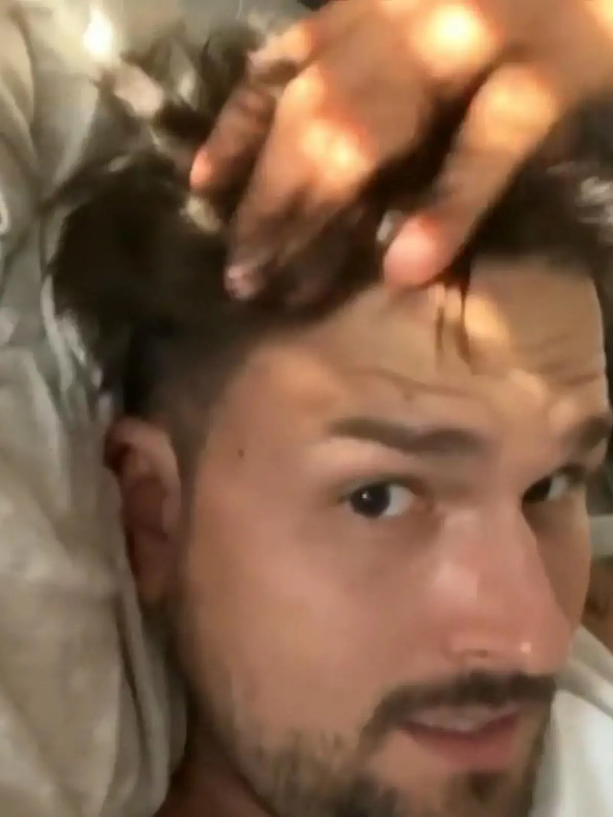 Bild zu: "Marco Cerullos Haar-Transplantation trägt Früchte!"