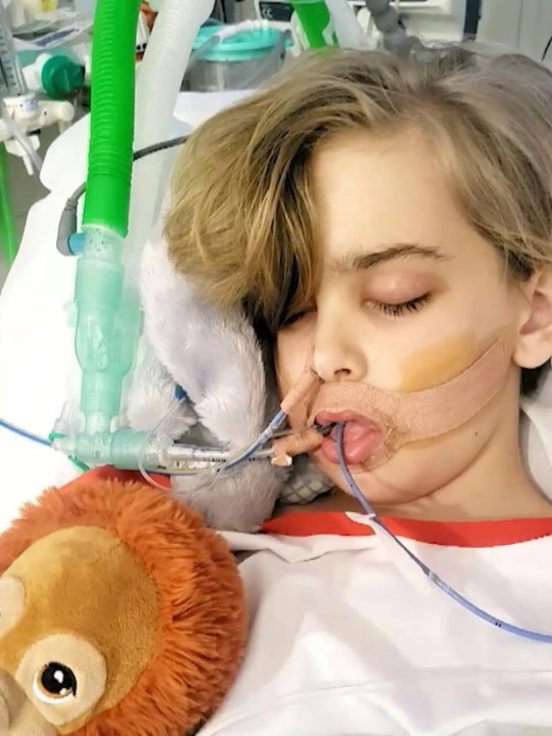 Archie Battersbee wurde nach einem Unfall für hirntot erklärt. Die Maschinen, die ihn am Leben halten, dürfen rechtmäßig abgestellt werden. Doch mit diesen Aufnahmen will seine Mutter beweisen, dass ihr Junge noch selbstständig atmen kann.-