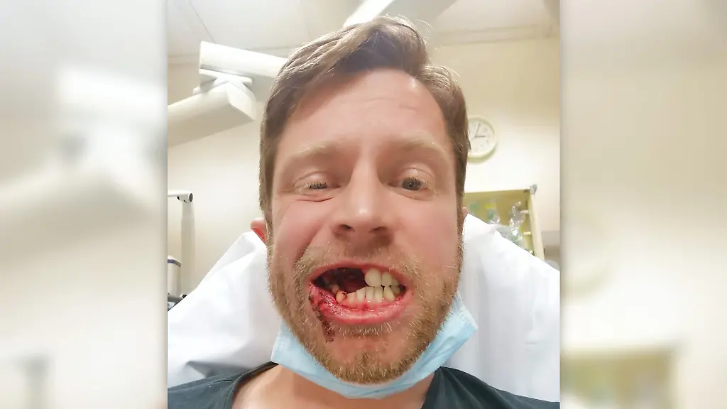 elfbar elfa master akku Wie vermeide ich, dass sich meine Zähne durch Snus verfärben?