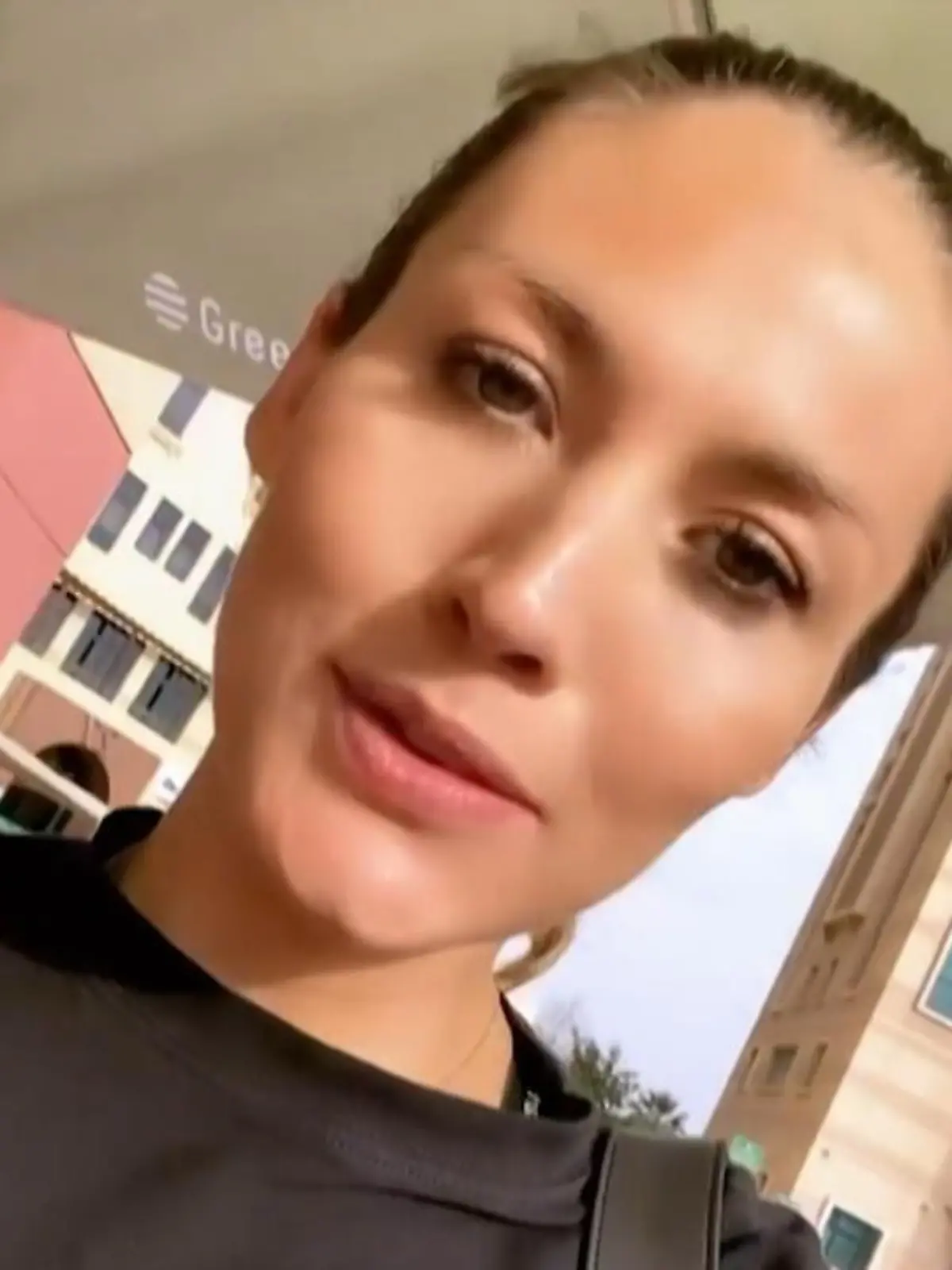 Bild zu: "Fiona Erdmanns Baby hat sich noch nicht gedreht"