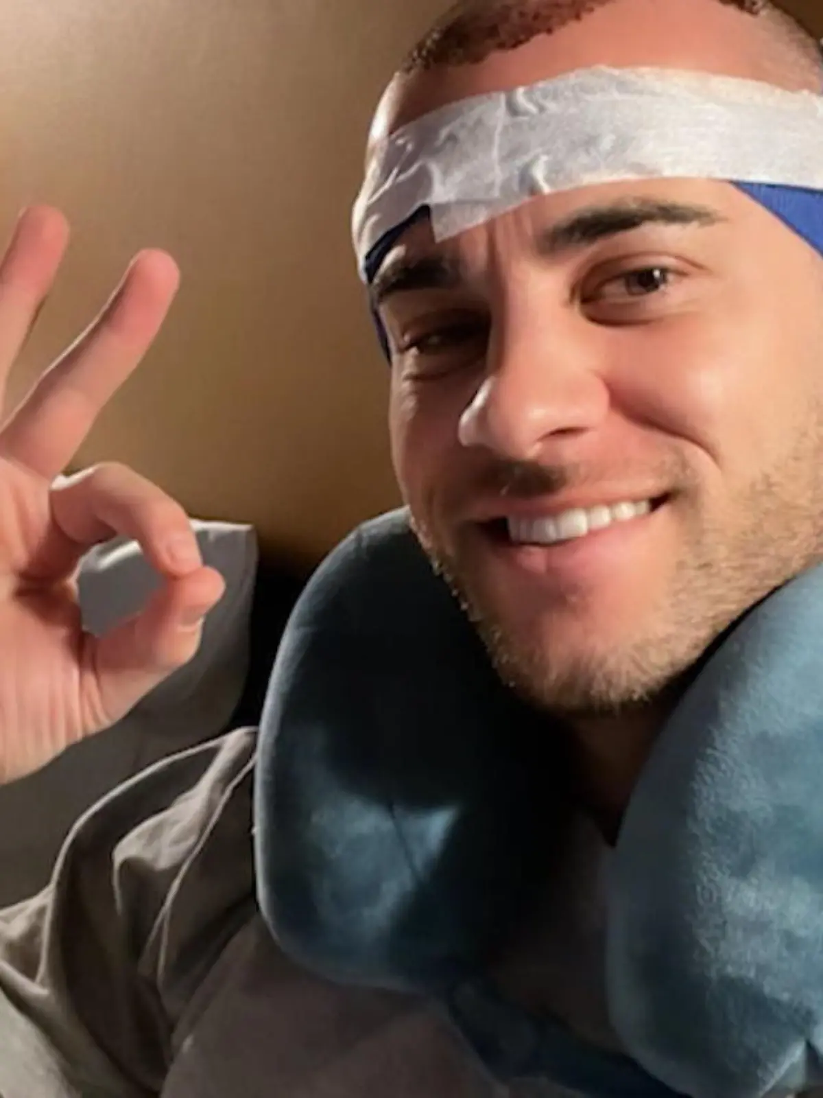 Bild zu: "Haartransplantation bei Serkan Yavuz"