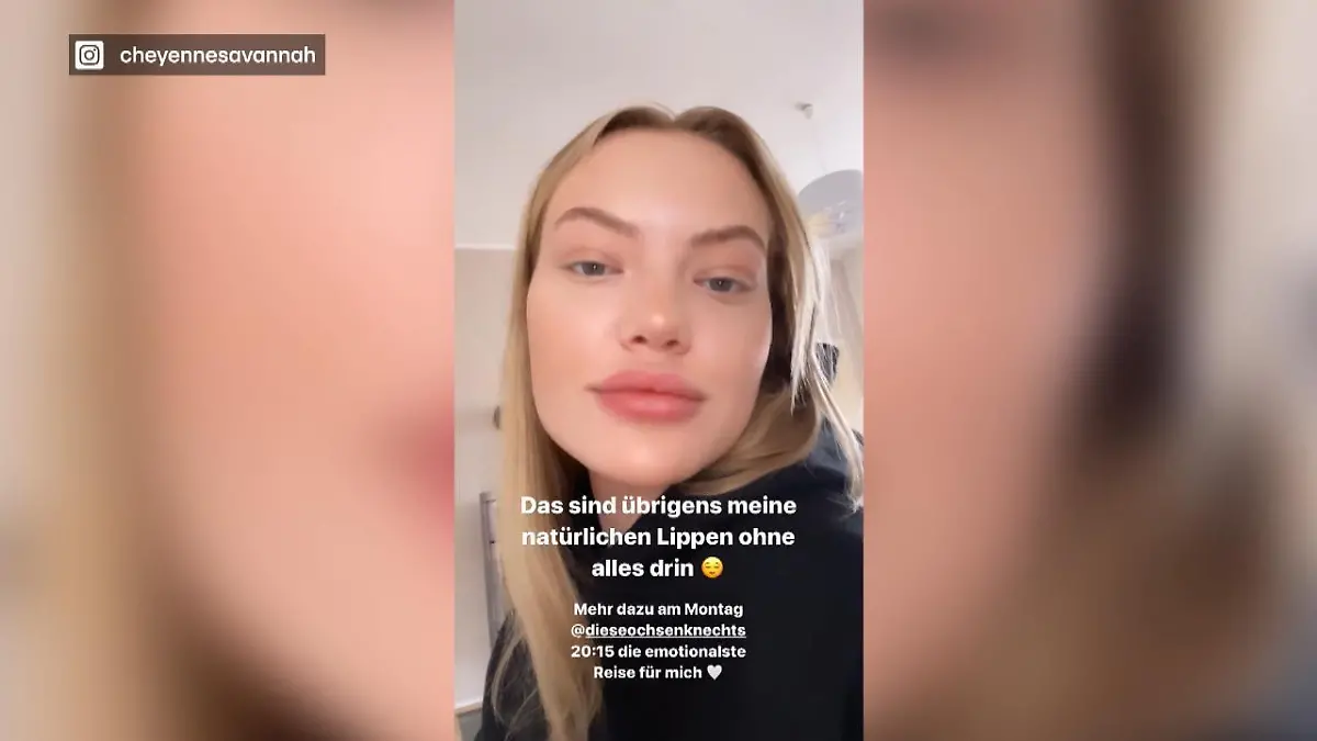 So sehen Cheyenne Ochsenknechts Lippen ohne Filler aus! Ganz natürlich