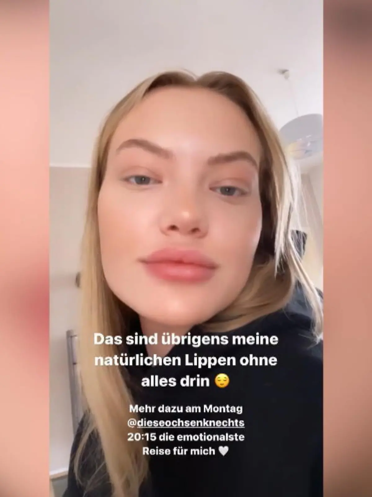 Bild zu: "So sehen Cheyenne Ochsenknechts Lippen ohne Filler aus!"