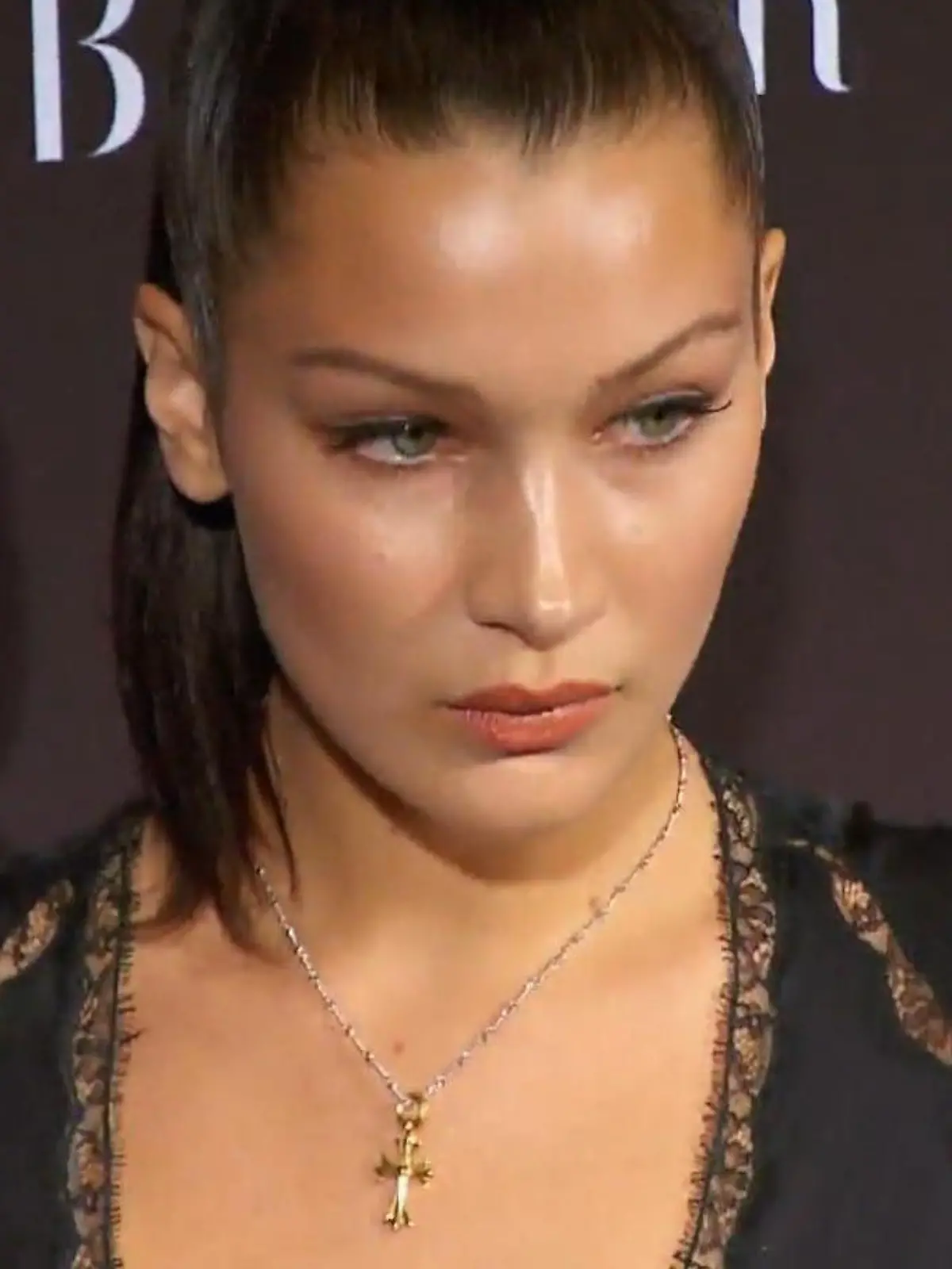Bild zu: "Bella Hadid gibt Beauty-Eingriff mit 14 zu"