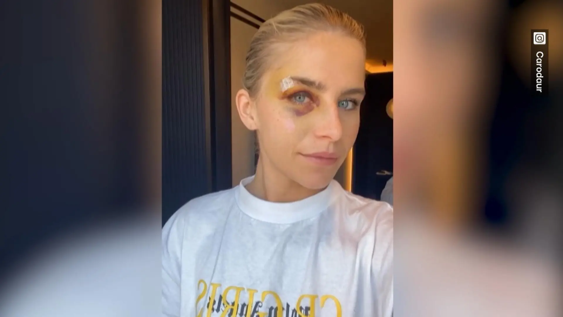 Caro Daur gibt Gesundheitsupdate Verletzung am Auge