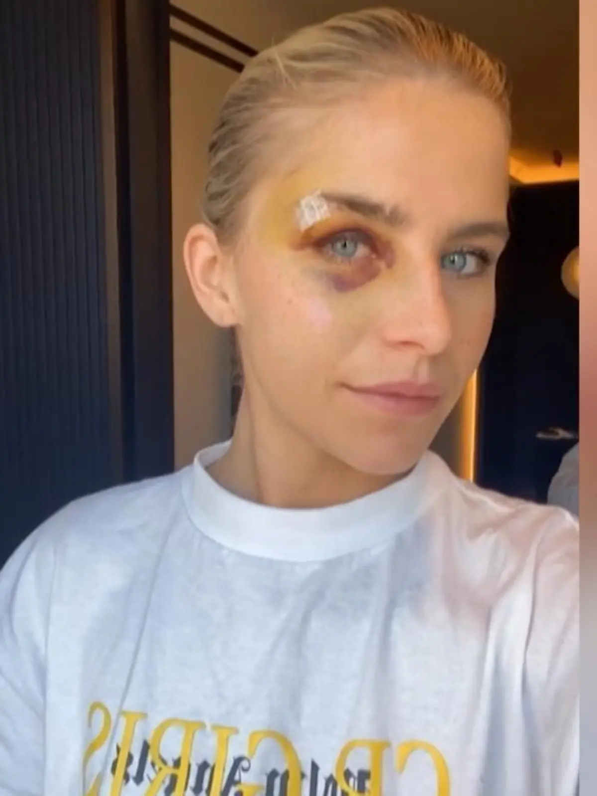 Bild zu: "Caro Daur gibt Gesundheitsupdate"