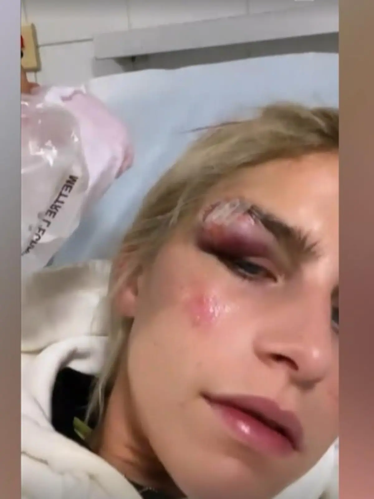Bild zu: "Caro Daur hatte blutigen Jogging-Unfall"
