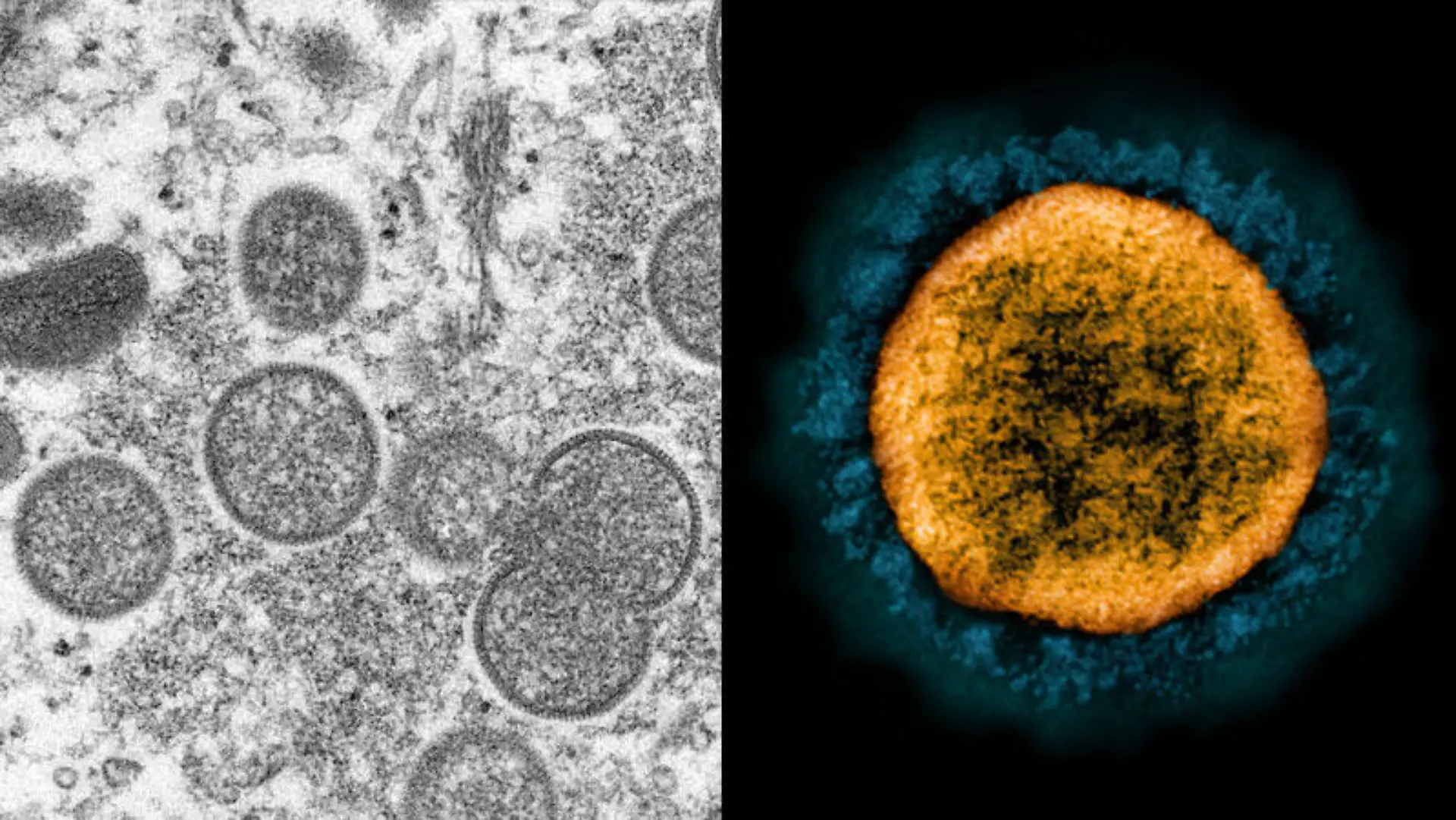 Zwei auf einen Schlag? Experten sagen, dass eine Doppelinfektion von Sars-CoV-2 und dem Affenpocken-Virus möglich ist.