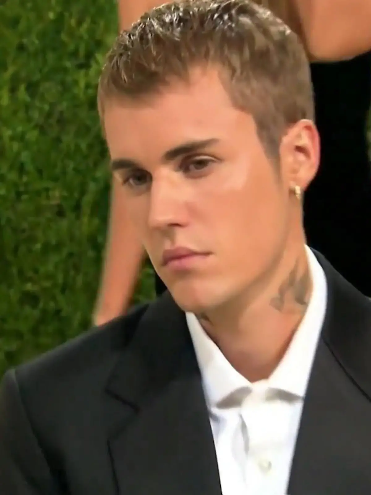 Bild zu: "Justin Bieber hat Corona! So geht es ihm"